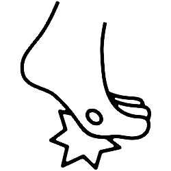 Tyúkszem eltávolítás